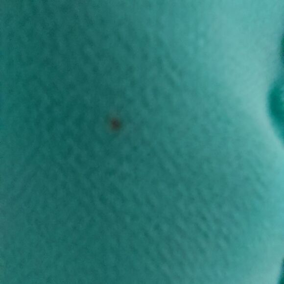 ENTRO DRESS - Picture 7 of 11